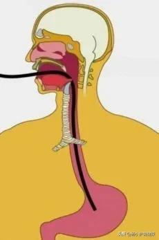 医院下胃管难受吗?