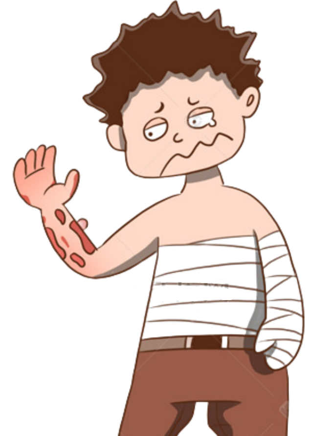 烧伤的早期处理:关注军营常见烧烫伤