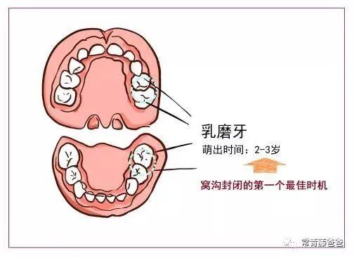 6-12歲換牙時間和換牙期問題大盤點!