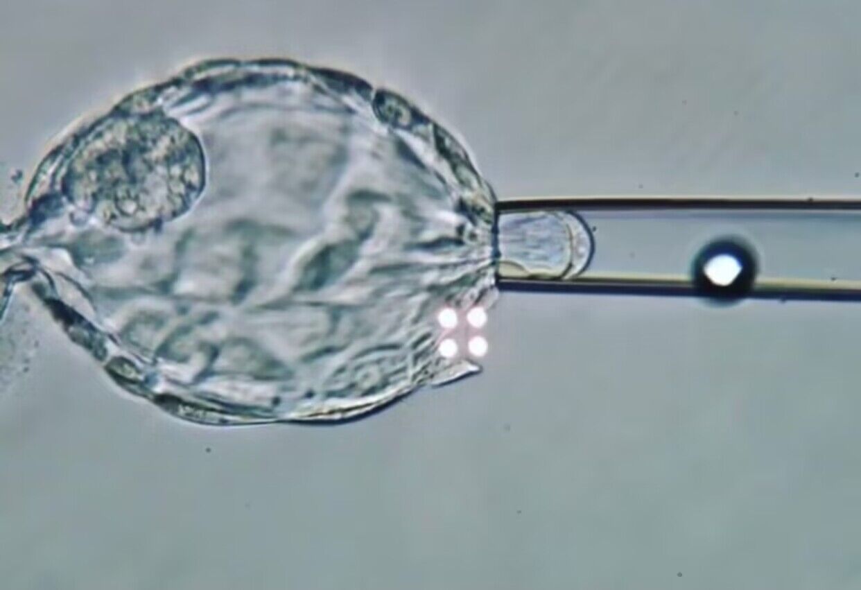 为什么做第三代试管婴儿都建议甚至必须要养囊?