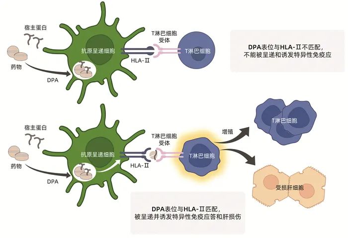 免疫特異質dili發病機制