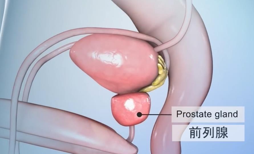 探秘男性肛门指检:前列腺隐藏的秘密!