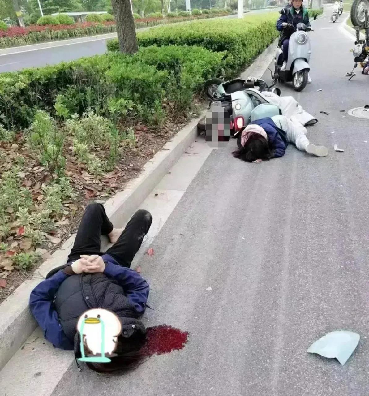这个女孩被撞的惨了,右腿180度旋转,完全变形,目测大
