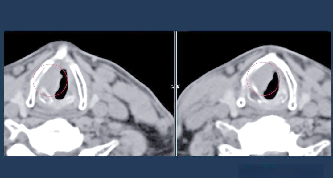 病例介绍及诊断要点详解