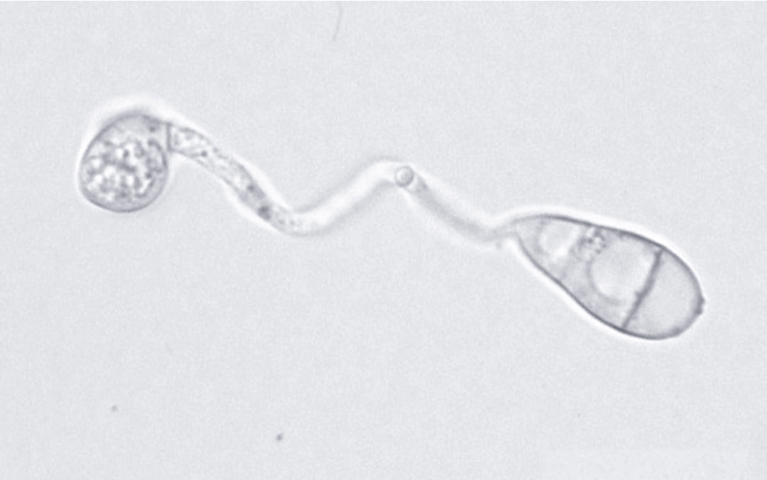 稻瘟病菌:影响全球粮食安全的重大隐患与多元化防控方法