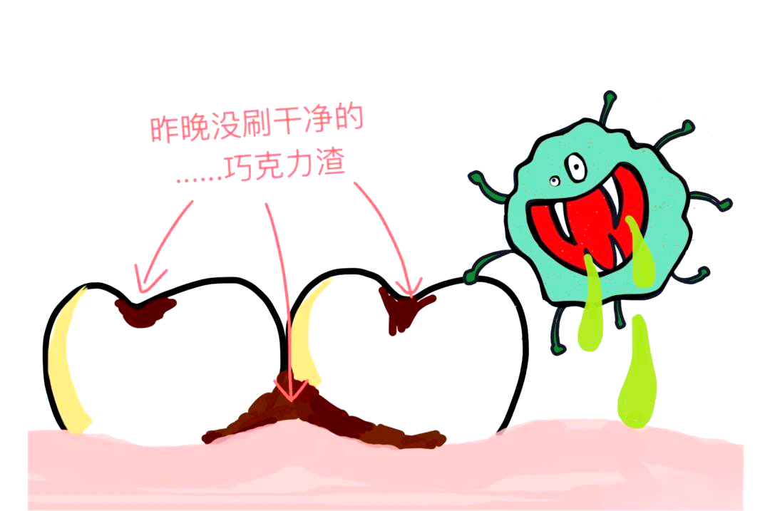 牙菌斑的自我介绍与预防之道