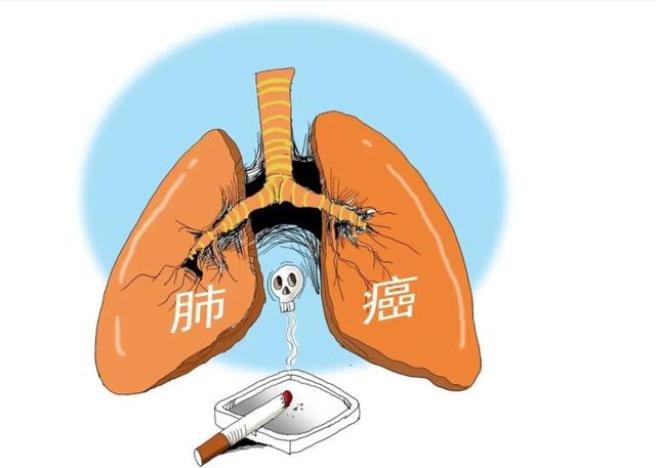 100个烟民中,有多少人会因吸烟患肺癌?或许答案与你想的不同