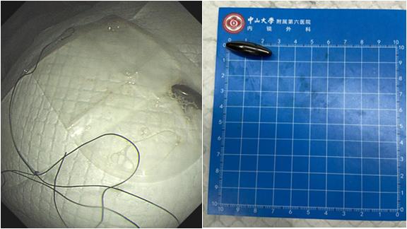 磁铁放在肚子上有什么好处_磁铁放在身上对身体会不会有危害 磁铁放在肚子上有什么长处_磁铁放在身上对身材会不会有危害（磁铁放在肚子上有什么好处） 磁力资讯