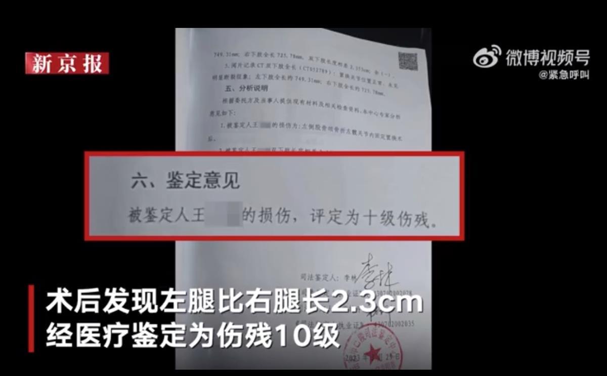 女子骨折做手术后左腿变长23厘米鉴定为十级伤残医院嫌患者索赔26万元