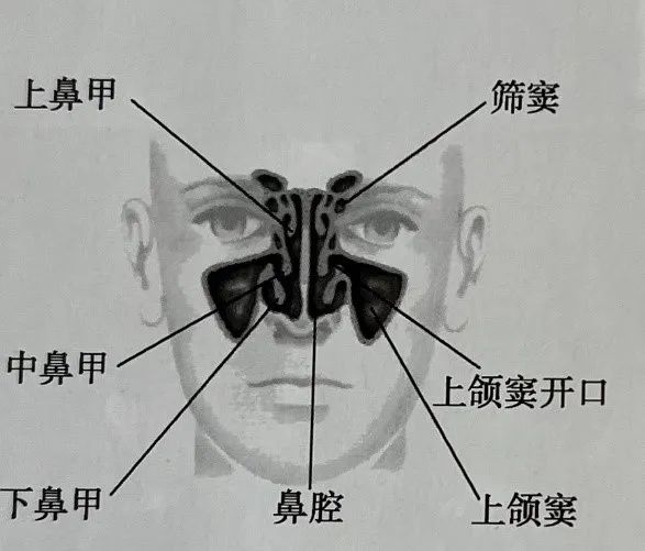 上颌窦的位置图片图片