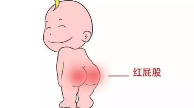 红屁屁应该怎么处理,纸尿裤如何挑选?
