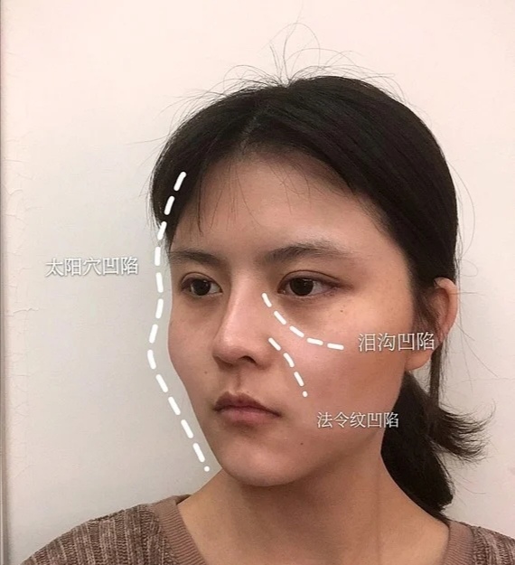 女生脸上有这些特点,是天生的"苦相脸",颜值低还不讨喜