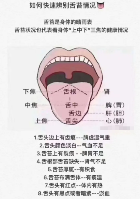 正常舌头图片看病图解图片