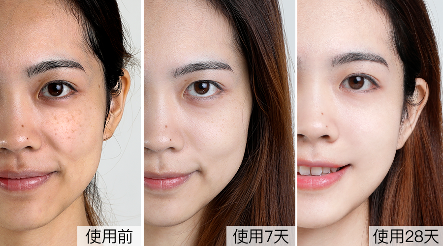 皮肤科医生透露:药店有一种擦脸的,16天淡色斑,可惜很少人知道