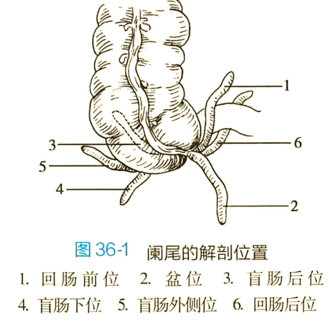 胃肠医生全面解析阑尾炎:从基础到深入