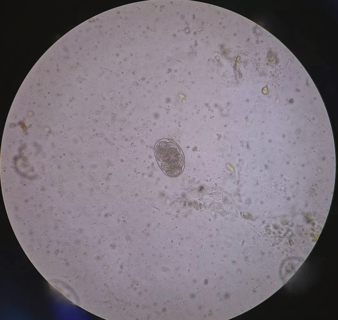 二,第二,三日的观察显示,钩虫卵的大小约为