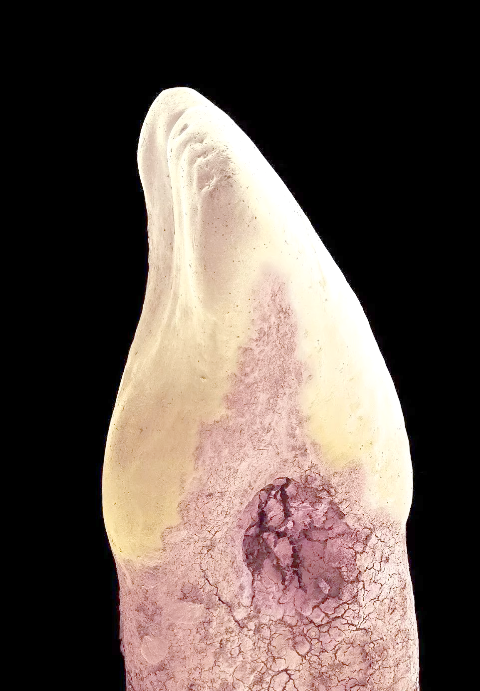 放大1000倍揭示细菌世界:激发孩子养成良好口腔卫生习惯