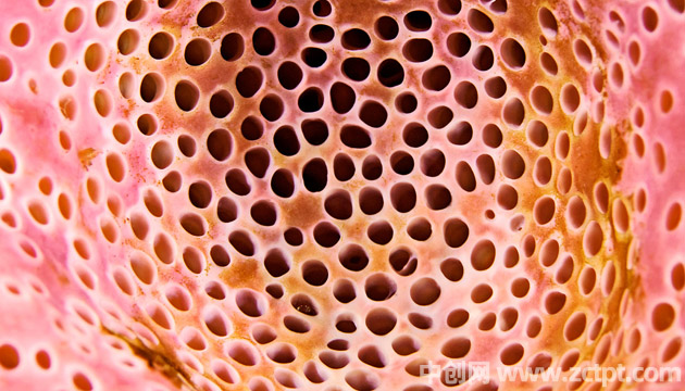 玉米男孩是真实事件吗,玉米男孩图片原图恐怖吗(十宗罪几) Holes in the body/BY