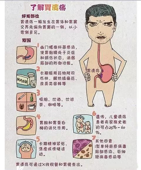 胃溃疡四个表现很严重