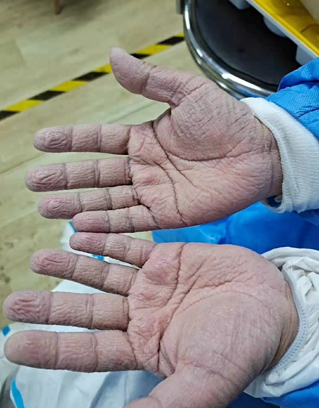 探访郑州疫情防控:正全员核酸检测,有医护人员工作超30个小时