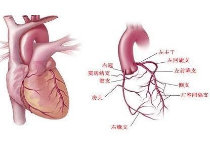 血管外科刁永鹏:什么是冠状动脉ct?其中这4方面要注意