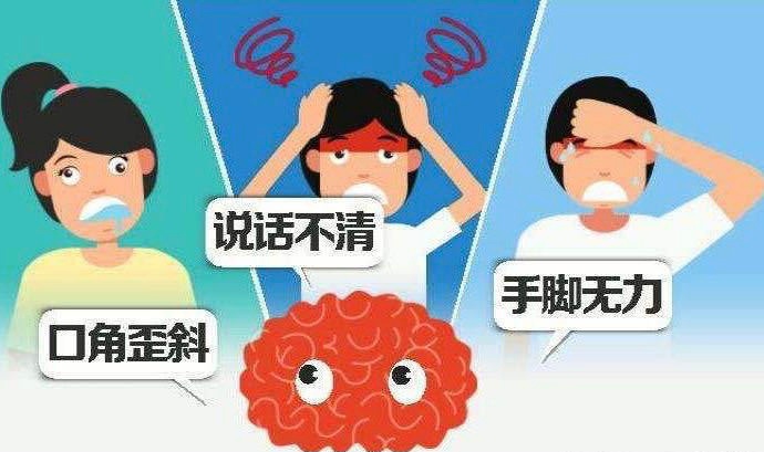 脑卒中瞄上年轻人