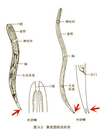 粪类圆线虫感染的检验与临床特征详细解析