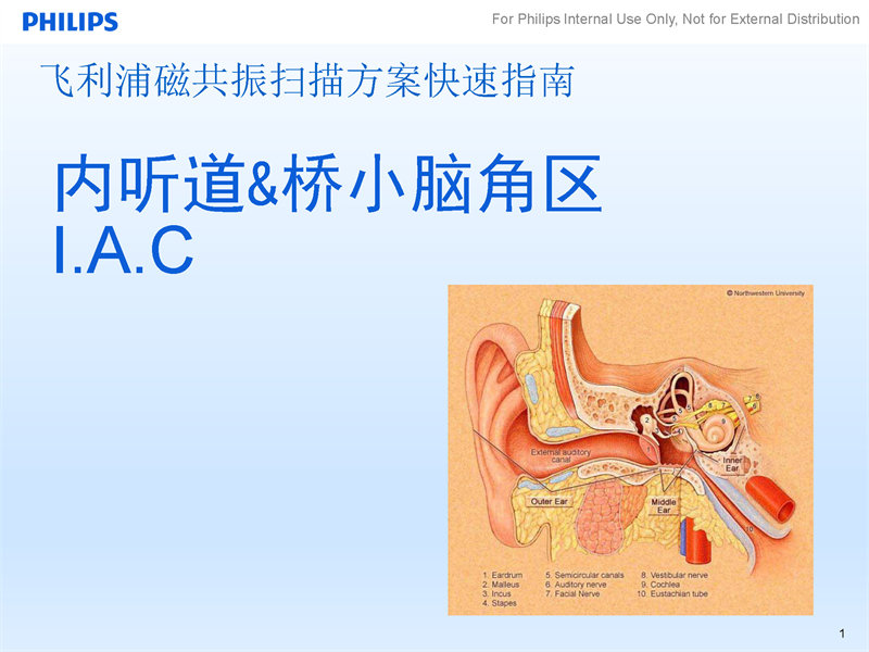 内听道扫描方案|磁共振规范化扫描方案|飞利浦