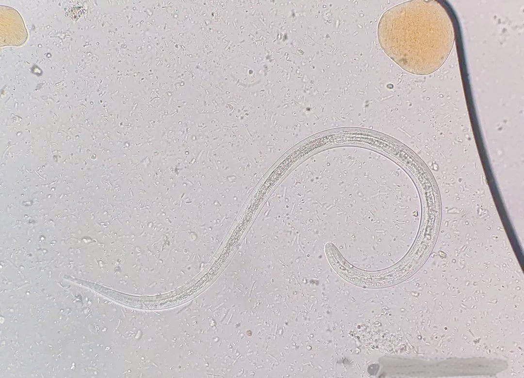 显微镜下的挑战:从质控图看粪类圆线虫