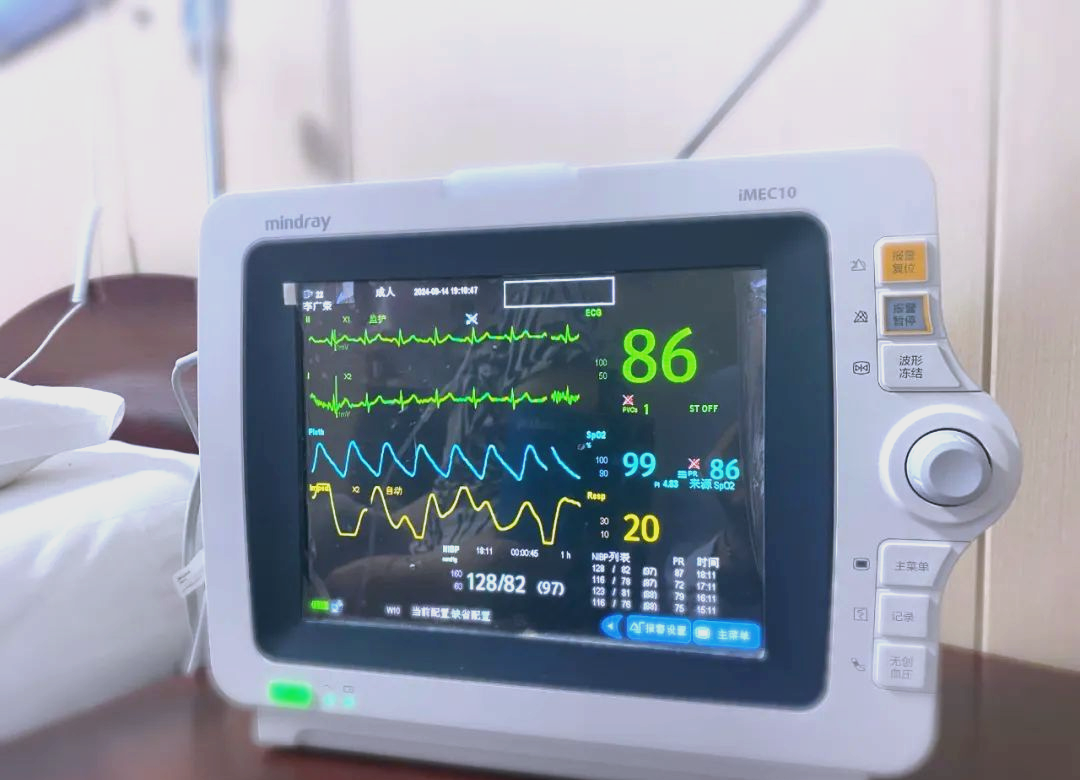 心电监护仪:您了解这个常见的医疗设备吗?