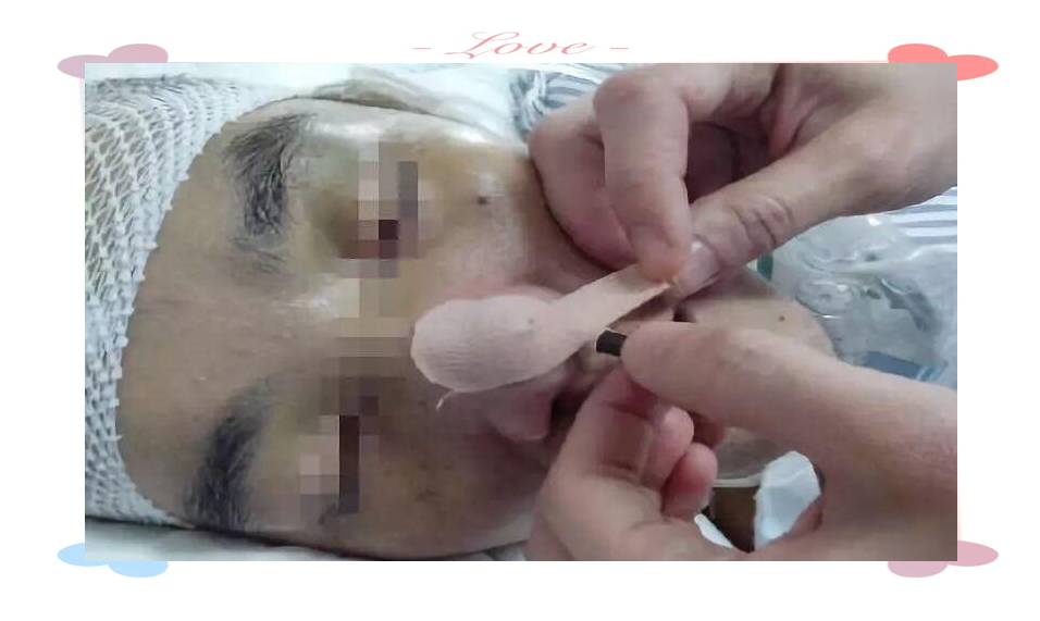 胃管固定技巧与健康教育的重要性探析