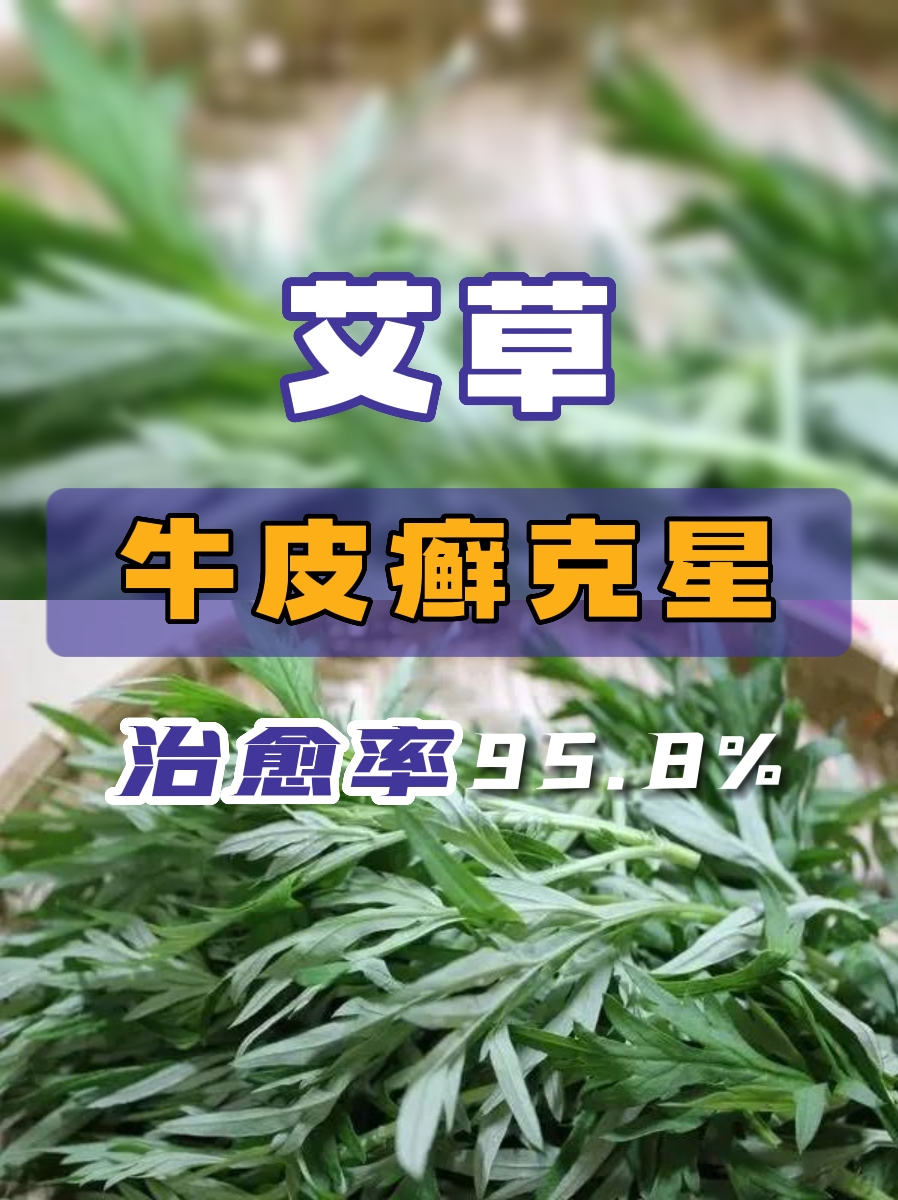 牛皮血癬症怎麼治療除根