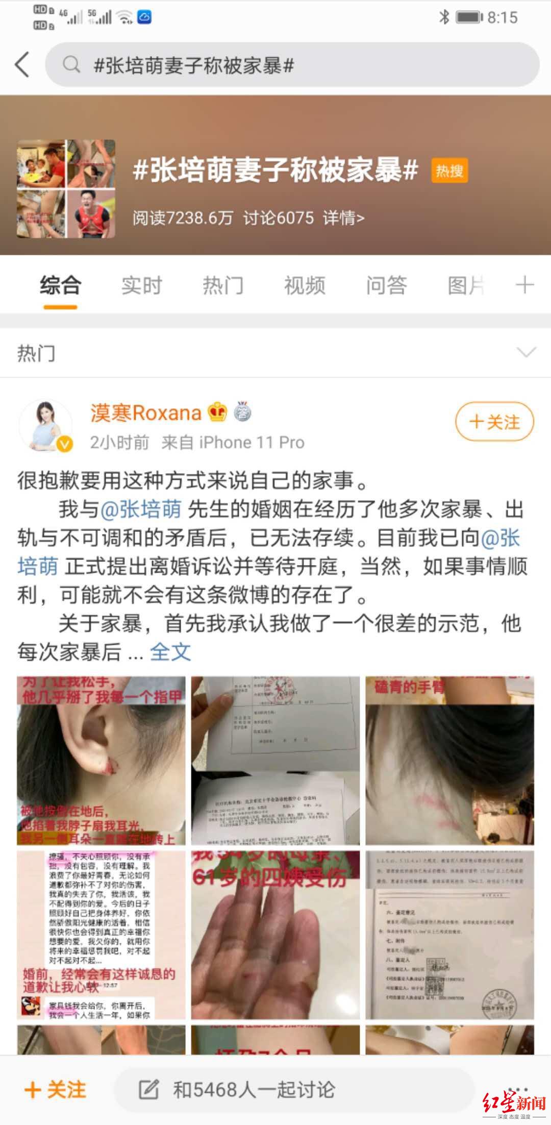 妻子曝短跑名将张培萌家暴及出轨,张培萌回应:无中生有