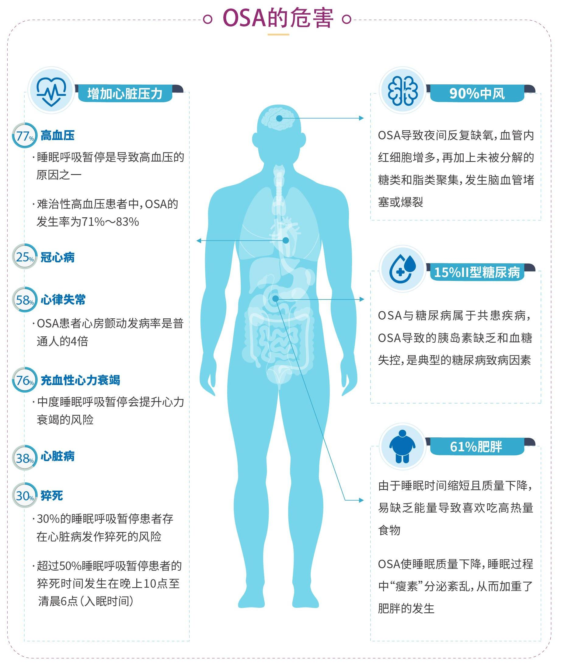 上海六院与清华大学合作发表论文:毫米波雷达技术助力睡眠呼吸暂停