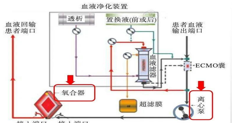 ecmo原理图解图片