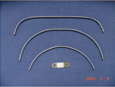 nuss手术是怎么做的,到底好不好?