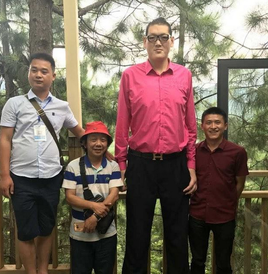 "巨人"张欢遭妻子嫌弃,称其生活已不能自理,直言后悔嫁给他