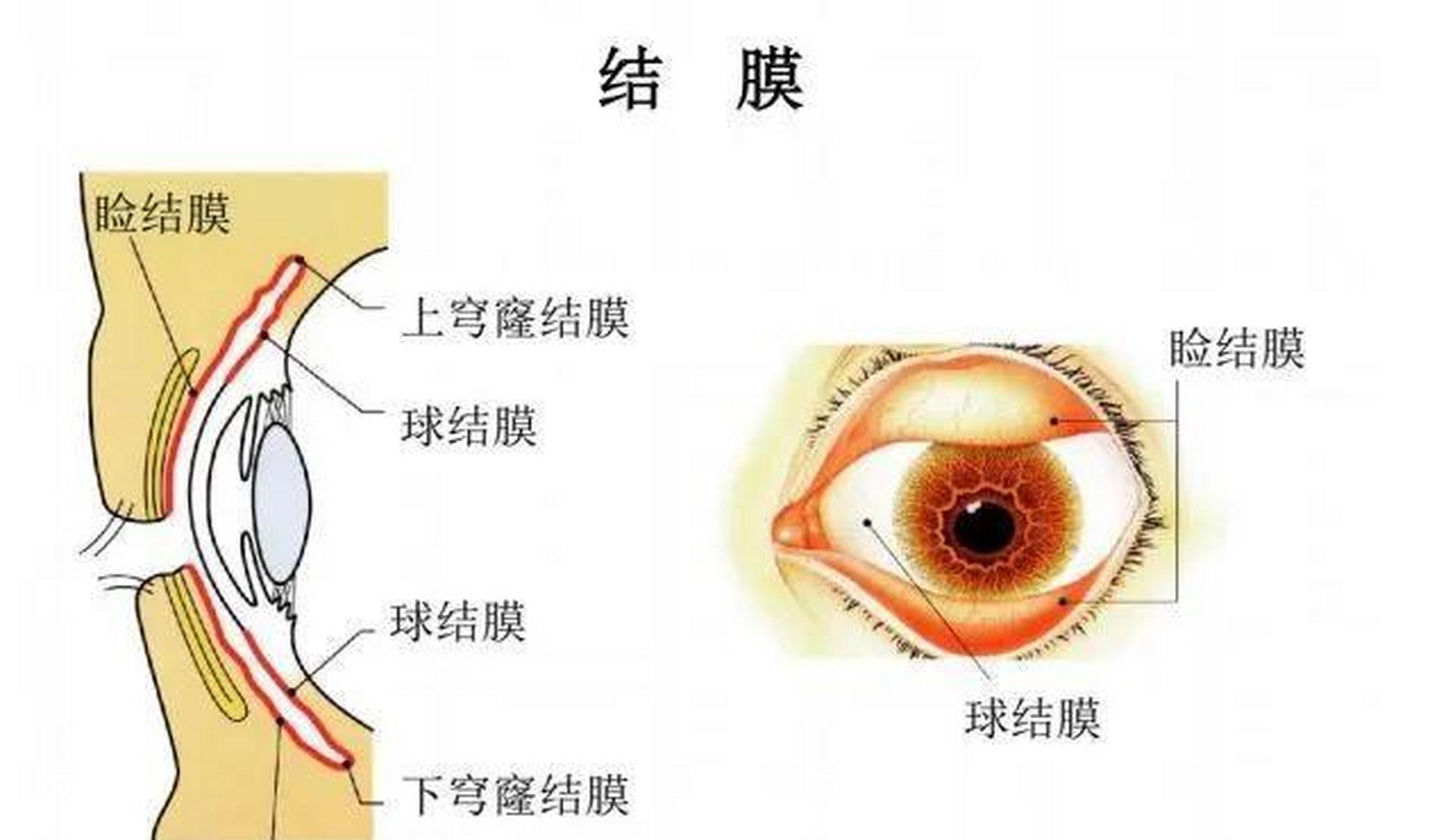 最近,新冠二阳成了热搜,这次的主要症状是"结膜炎",不少人开始