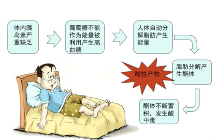 乳酸性酸中毒起病急, 病人可能会出现意识模糊,昏迷等情况.