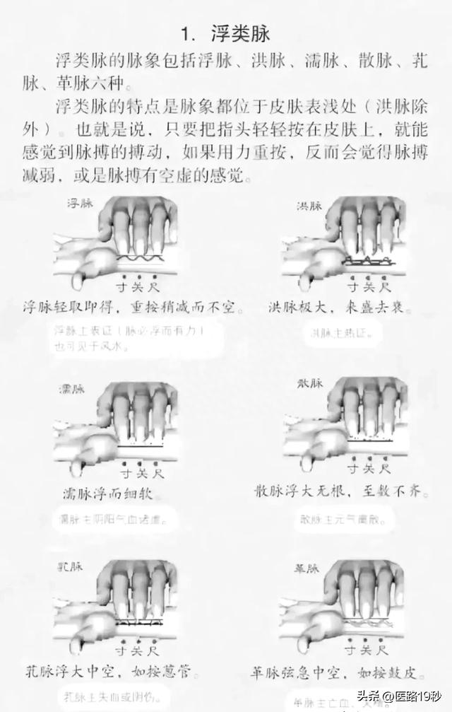 如何学中医28脉?先学这6种脉象