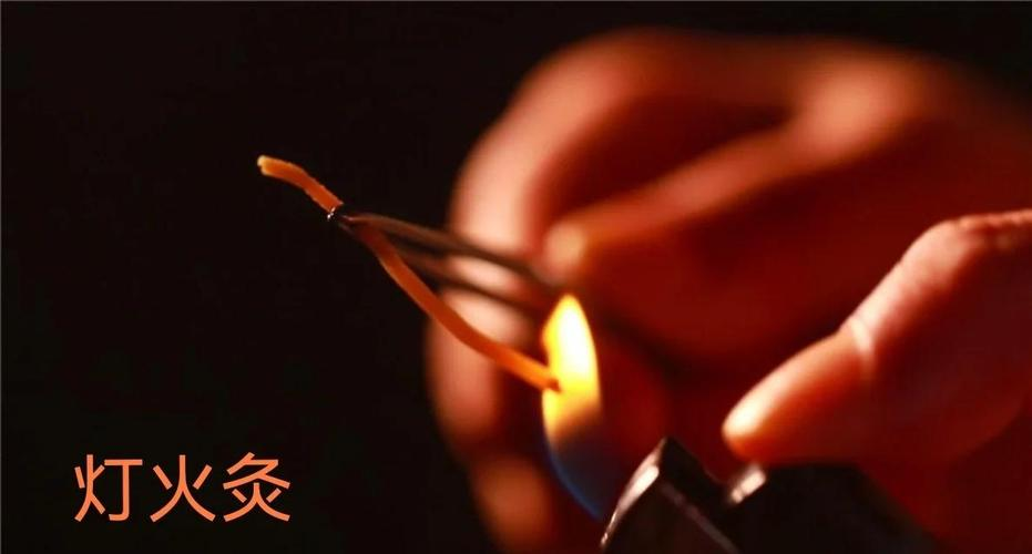 民间珍宝:灯火灸的神奇疗效与施术要点