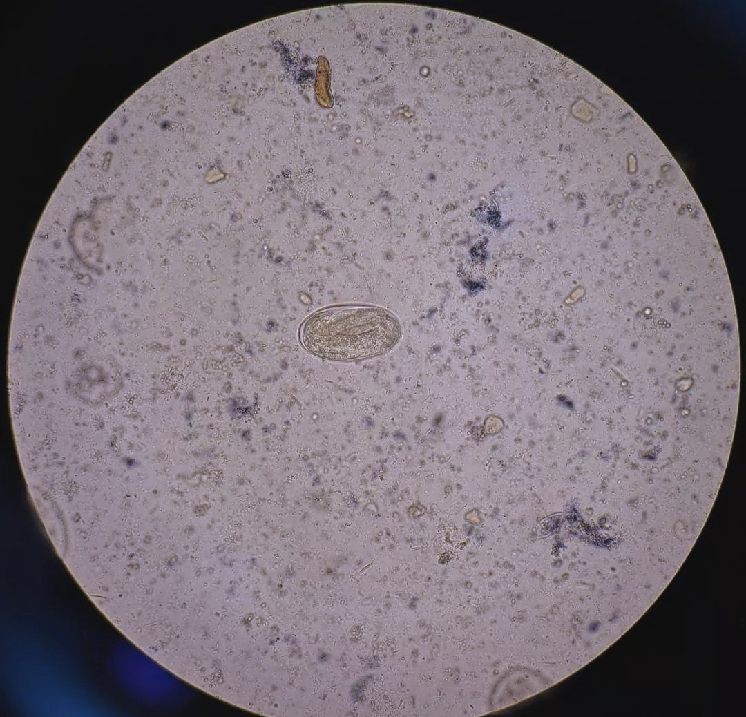 钩虫病感染:从虫卵到钩蚴的完整培养历程