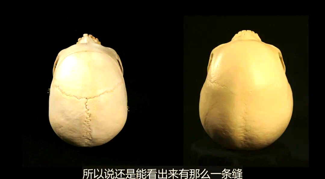 帕拉卡斯头骨:神秘起源与人类历史的重新探索