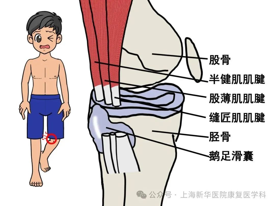 鹅足腱位置图图片