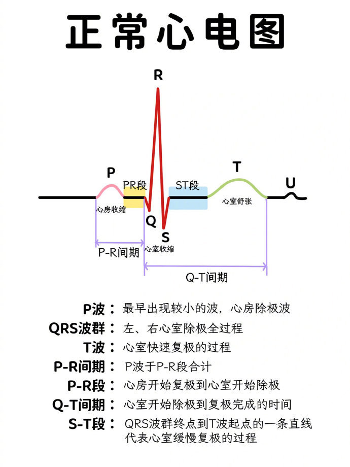 终于有人把心电图怎么看懂讲清楚了(转)