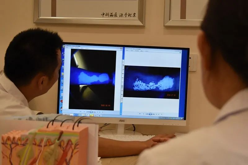 去医院照了伍德灯(wood灯),怎样才能确定就是白癜风呢?