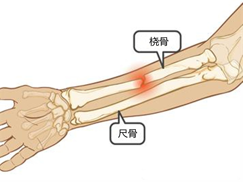 手臂疼痛,如果出现这几种情况,请立即就医