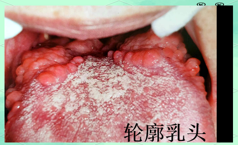 叶状乳头位于舌根两侧,呈现长圆形,由数条横行的叶片状黏膜