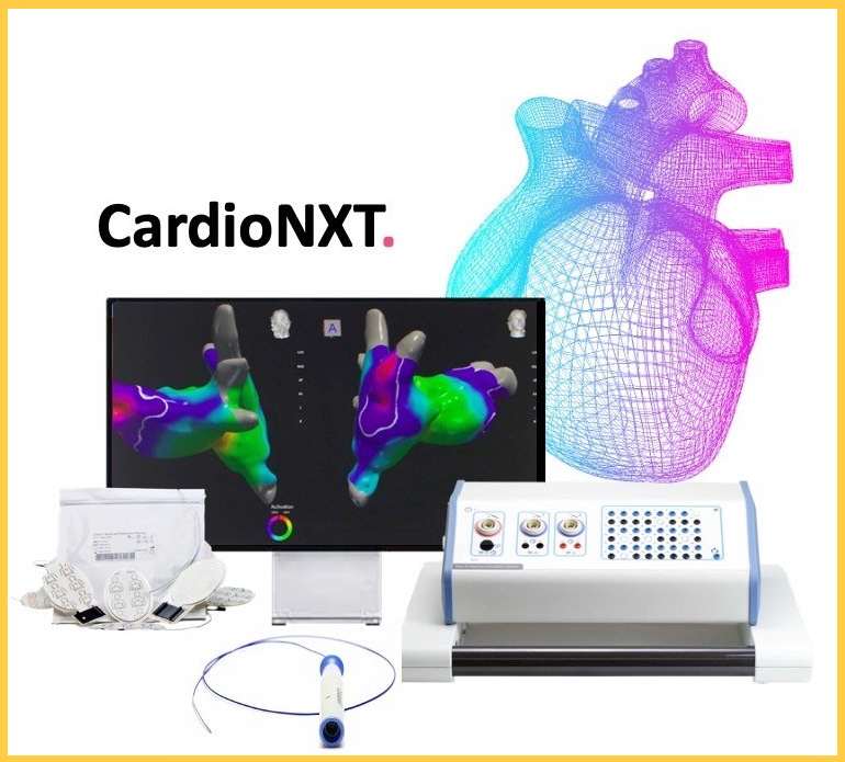 全球8款心脏电生理标测工具大比拼