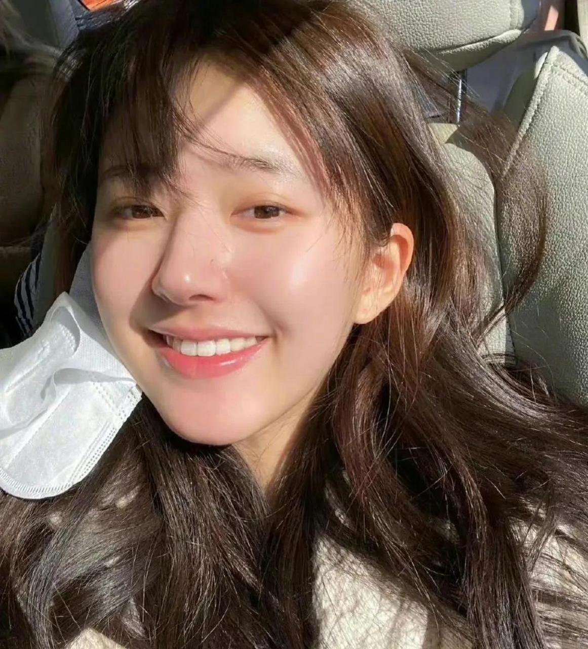 脸颊上的毛孔和下巴上的闭口都清晰可见,昨晚看后浪,赵露思皮肤白的